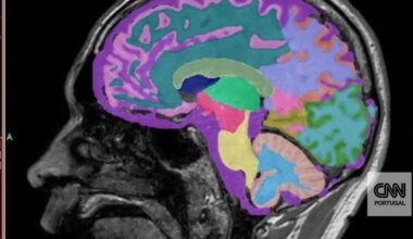 "Que bom, estou a voltar a ser o que eu era antes de ser diagnosticada com Alzheimer": há uma descoberta que traz "nova esperança"