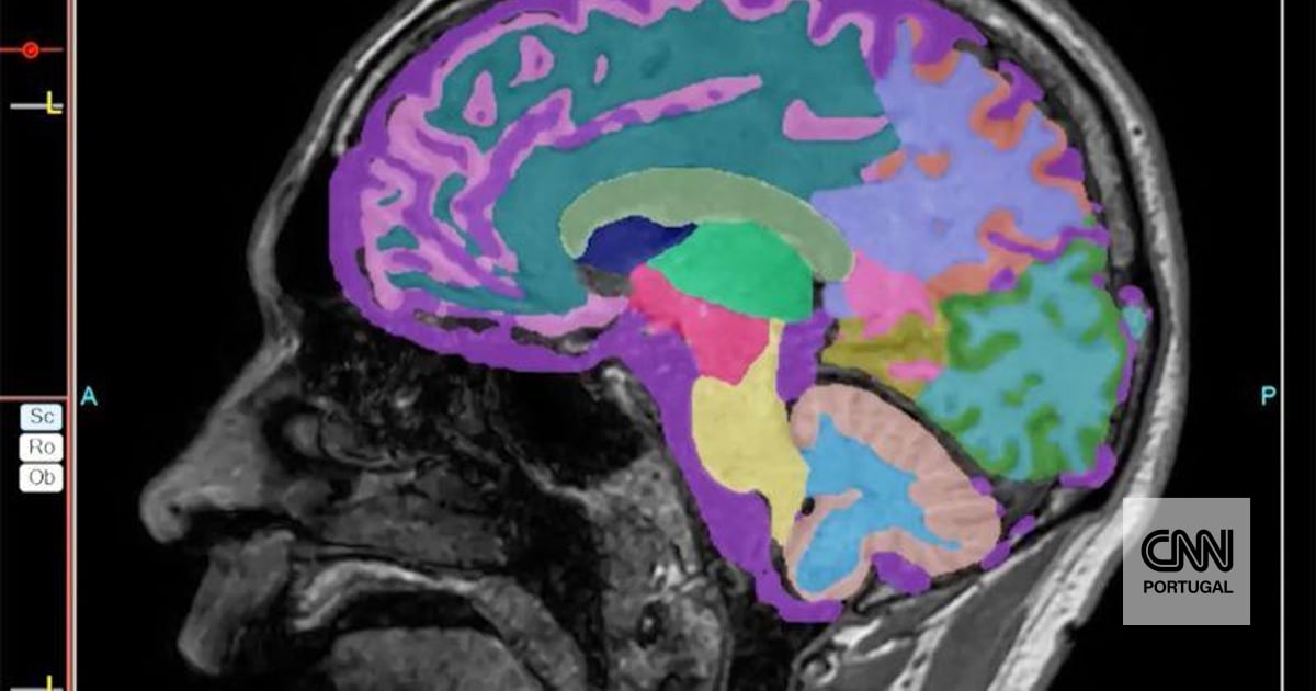 "Que bom, estou a voltar a ser o que eu era antes de ser diagnosticada com Alzheimer": há uma descoberta que traz "nova esperança"