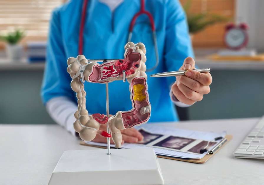 Pessoas com menos traços de ancestralidade asiática ou africana têm mais risco de câncer colorretal - Ceará