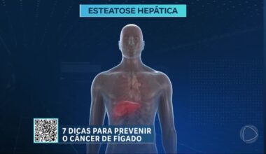 Alimentação saudável pode prevenir acúmulo de gordura no fígado – Noticias R7