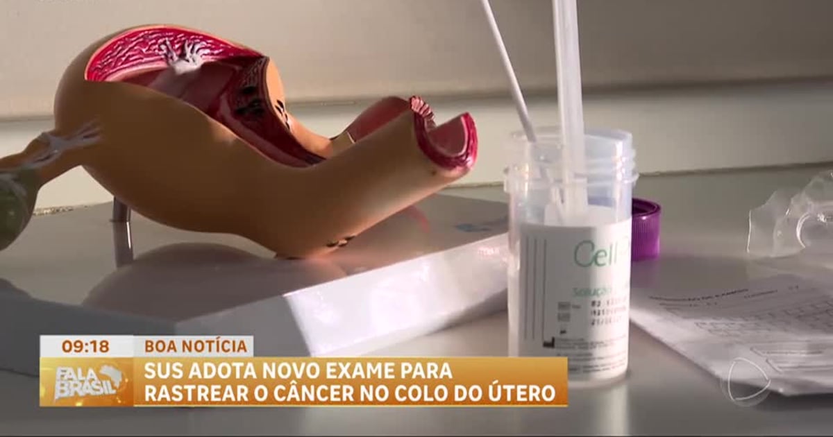 Novo exame PCR HPV é implementado no SUS para detecção precoce – Record