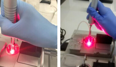 Pesquisas da UFSCar avaliam eficácia do laser na redução de sintomas da menopausa