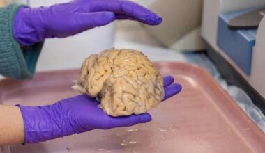 Cérebro de um superager estudado por cientistas da Universidade de Northwestern: padrões celulares distintos da população em geral é uma das causas da preservação cognitiva -  (crédito: Shane Collins/Northwestern University/Divulgação )