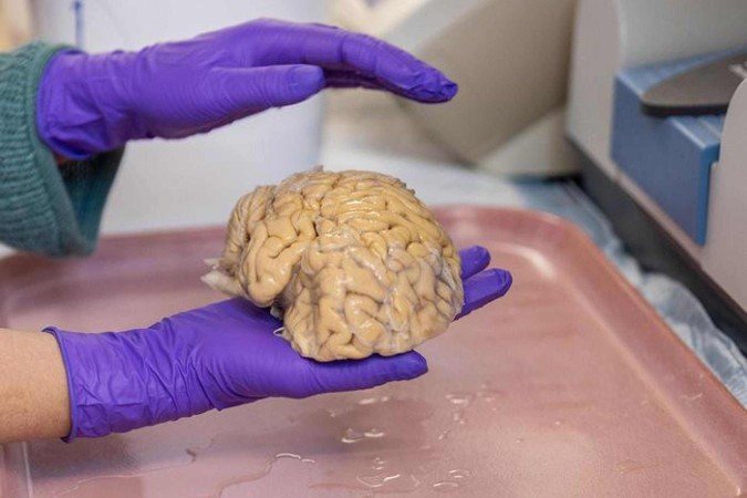 Cérebro de um superager estudado por cientistas da Universidade de Northwestern: padrões celulares distintos da população em geral é uma das causas da preservação cognitiva -  (crédito: Shane Collins/Northwestern University/Divulgação )