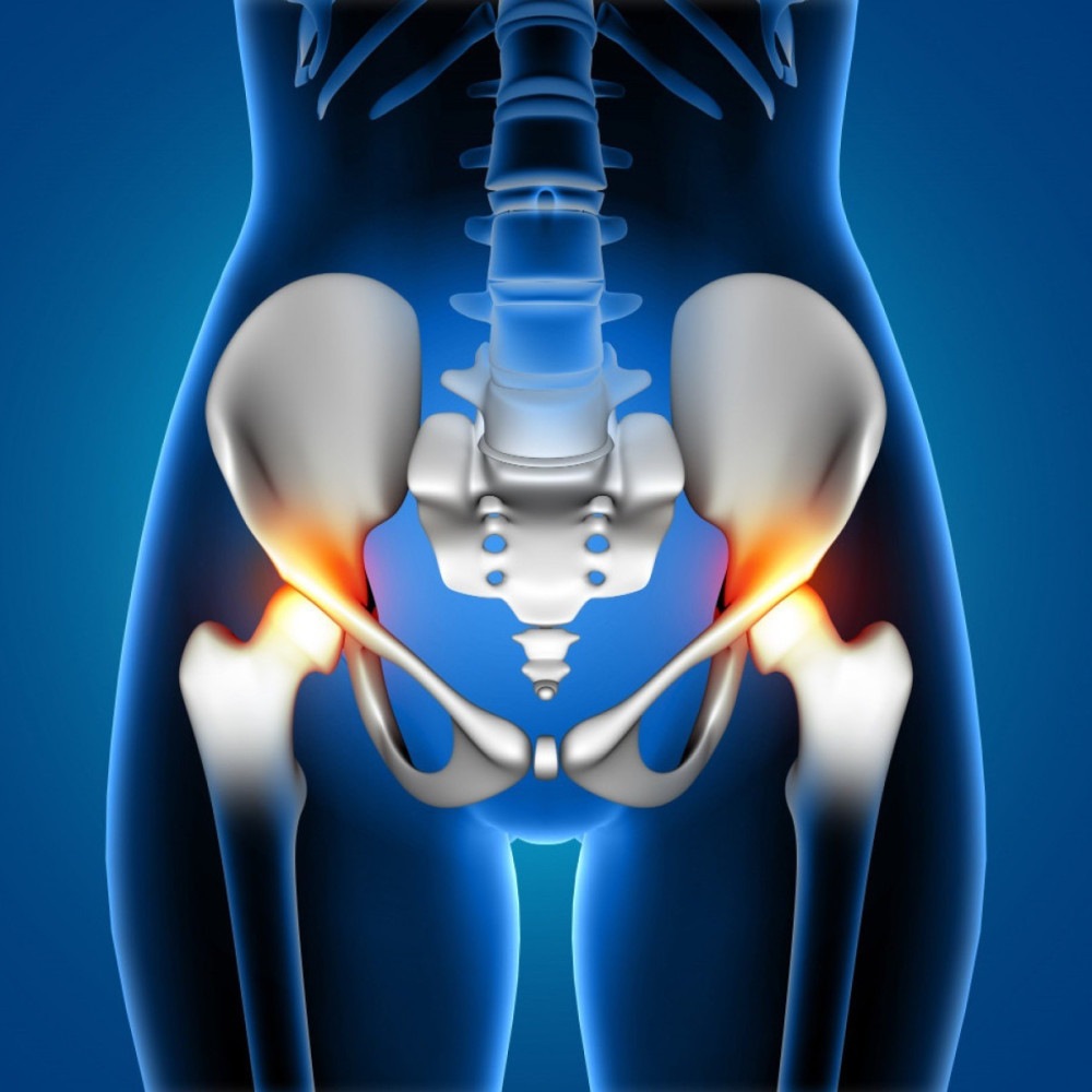 Covid-19, corticoide e osteonecrose: entenda a tríade
