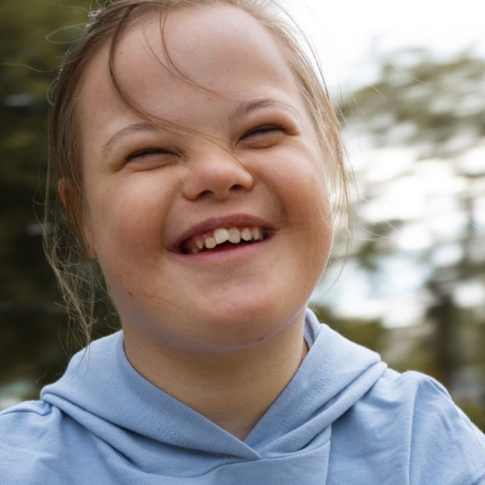 Quatro mitos sobre a saúde de pessoas com síndrome de Down