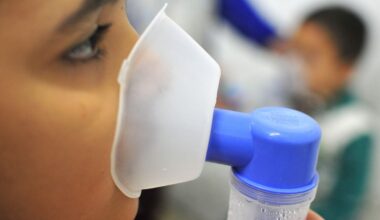 Casos de síndrome respiratória grave caem no país