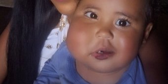 Ajuda a bebê Ayla Maria na cirurgia de um linfagioma