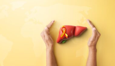 OMS classifica a hepatite D como cancerígena
