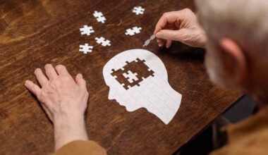 Superfícies Magnéticas Podem Influenciar Desenvolvimento de Proteínas Ligadas a Alzheimer – HealthNews