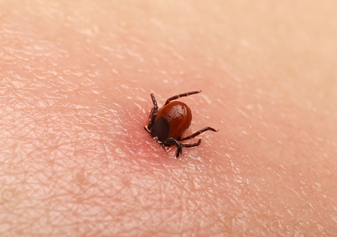 Esta é a doença de Lyme, a patologia que o cantor Justin Timberlake confessou sofrer