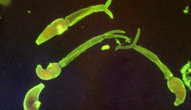 Cercárias de Schistosoma mansoni