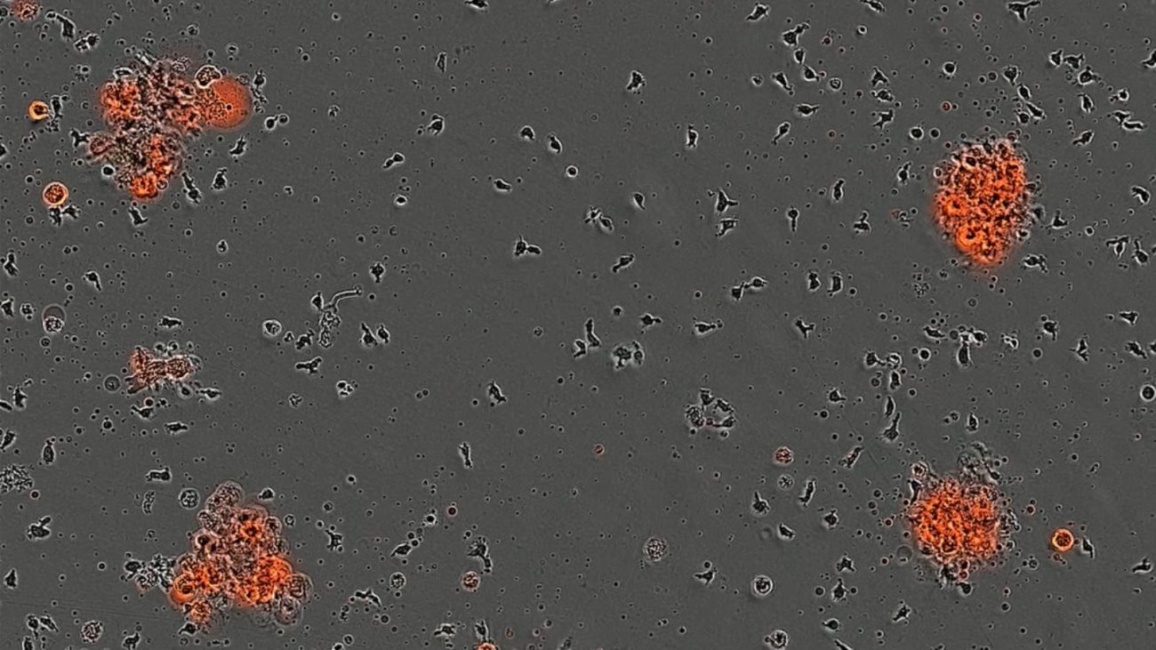 Imagem microscópica mostrando grupos de células T destacadas em tons alaranjados, indicando interação com células cancerígenas em experimento de laboratório.