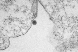 Imagens de microscopia mostram vírus Oropouche em ação