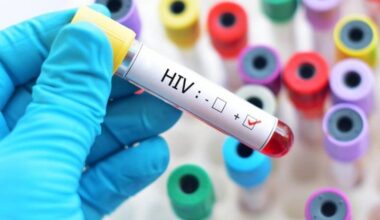Sesab desmente boato sobre surto de HIV/Aids entre jovens na Bahia