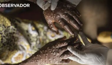 Mais 6 casos de Mpox em Moçambique em 24 horas – Observador