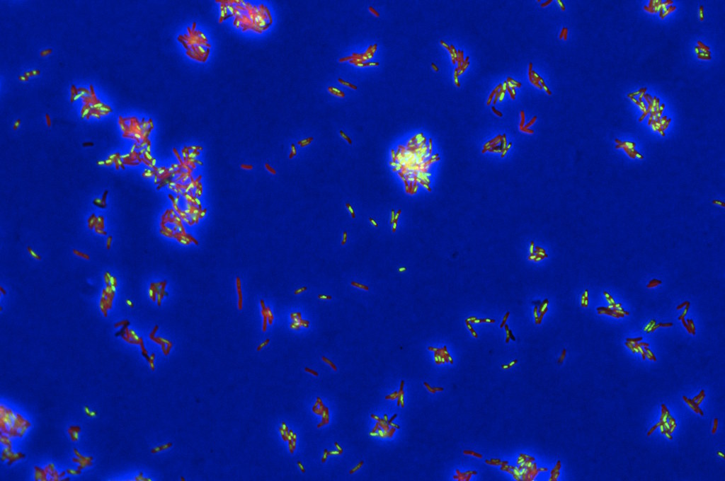 Nova ferramenta de IA desvenda como os fármacos matam a tuberculose e acelera combinações terapêuticas