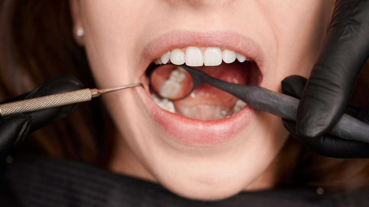 Um pequeno descuido no dia a dia pode custar todos os seus dentes, alerta USP
