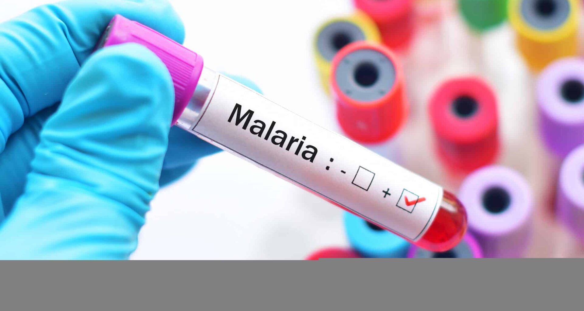 'Novo' mosquito transmissor da malária pode chegar ao Brasil