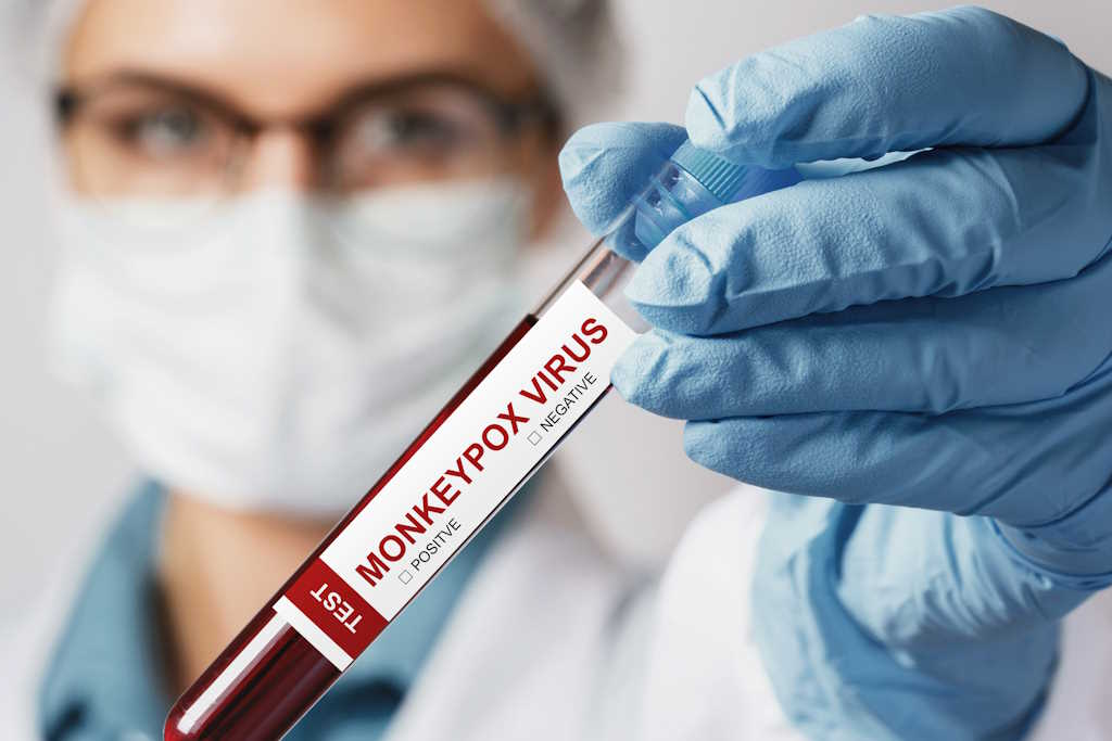 Mais de cinco mil casos e 46 mortos na Serra Leoa – HealthNews