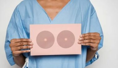 Aumentam casos de câncer em pessoas com menos de 50 anos, mostra pesquisa - Notícias
