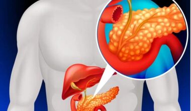 Diabetes: primeiro transplante experimental de células do pâncreas faz paciente voltar a produzir insulina
