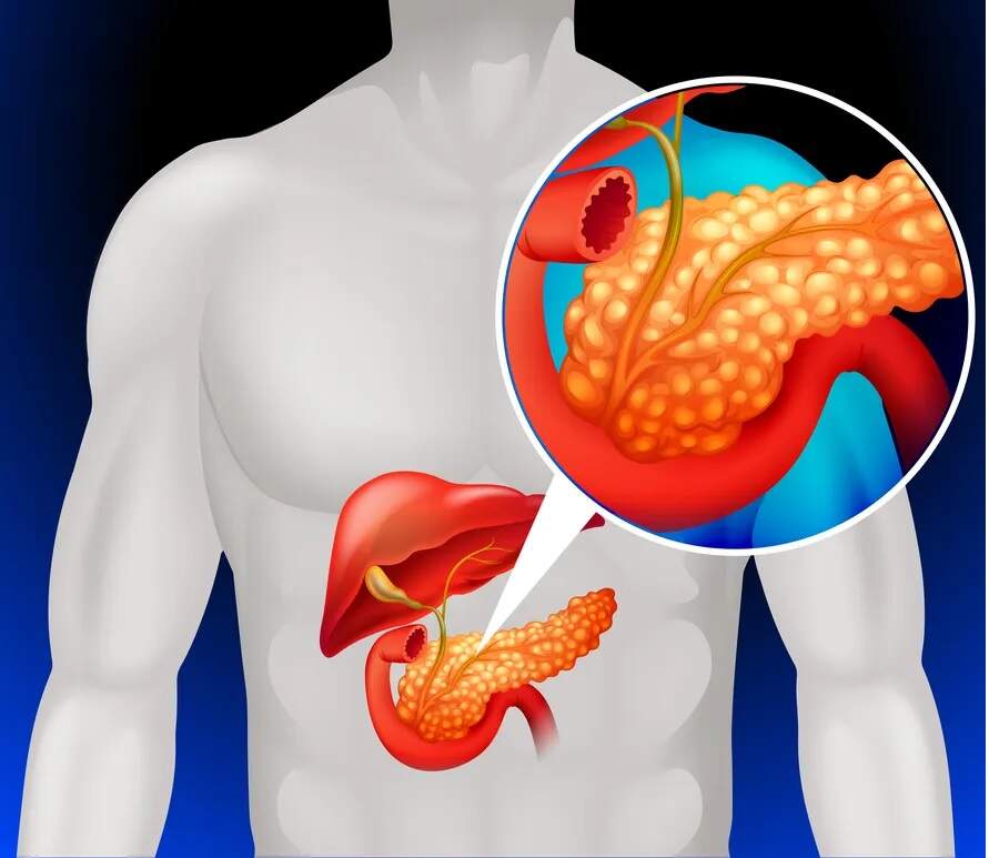 Diabetes: primeiro transplante experimental de células do pâncreas faz paciente voltar a produzir insulina