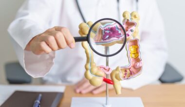 prevenção câncer de intestino