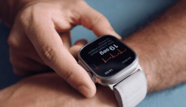 Detector de arritmia, infarto, saturação de oxigênio: nova geração de smartwatches revoluciona os cuidados com a saúde