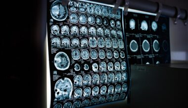 Descoberta proteína que pode reverter o envelhecimento cerebral