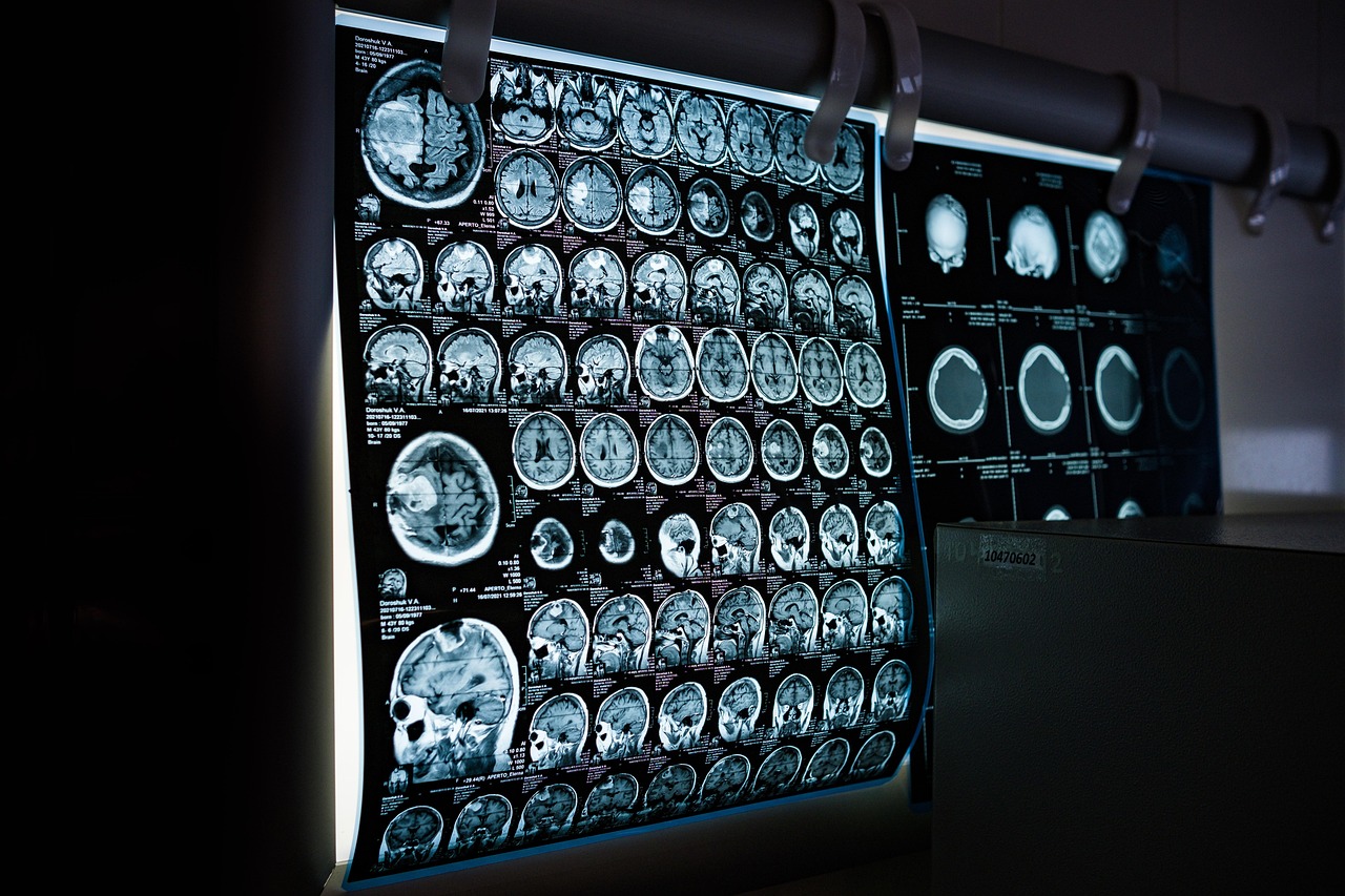 Descoberta proteína que pode reverter o envelhecimento cerebral