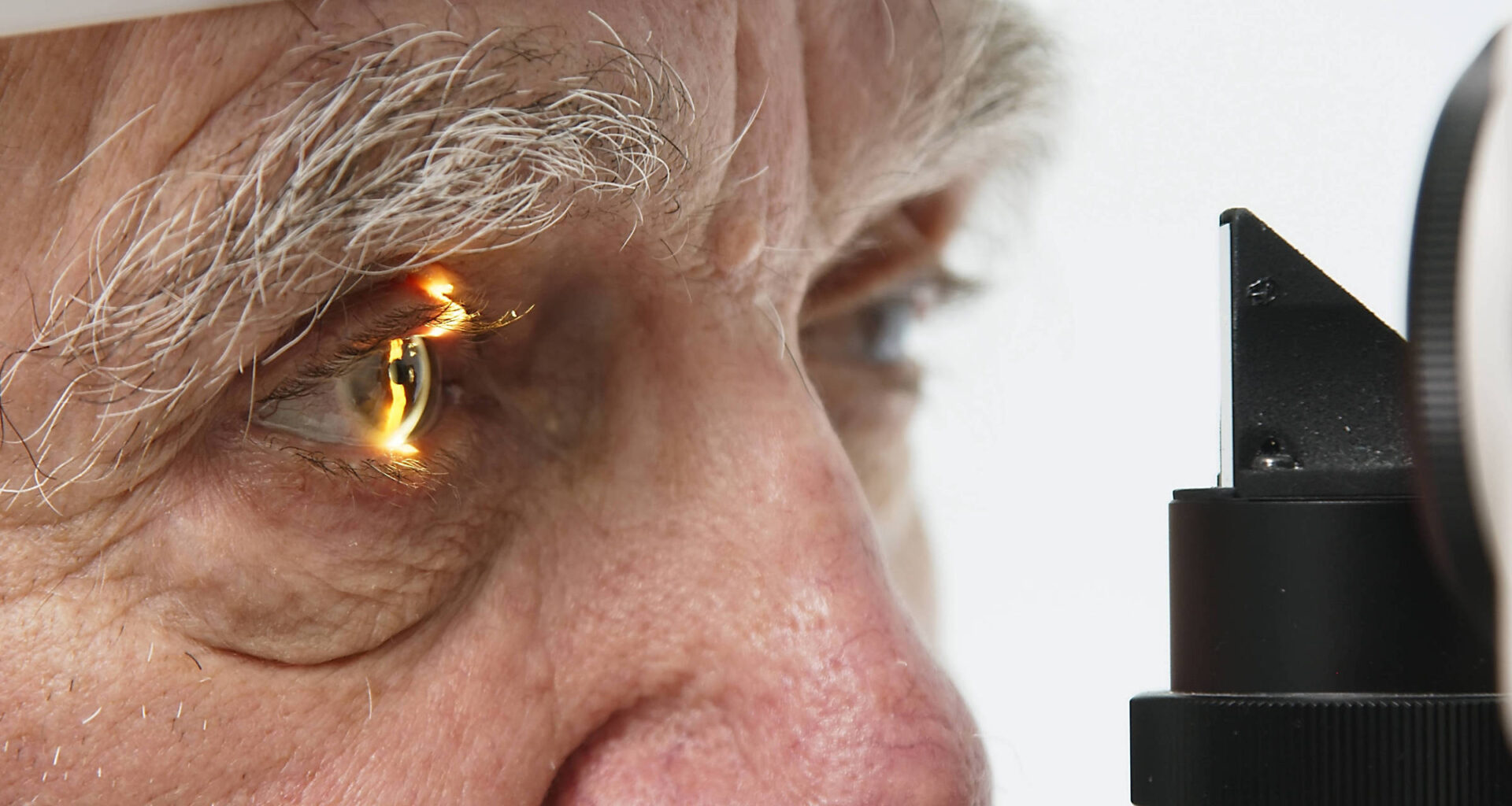 Alzheimer pode ser detectado em exame de vista no futuro - 07/09/2025 - Equilíbrio e Saúde