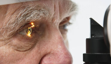 Alzheimer pode ser detectado em exame de vista no futuro - 07/09/2025 - Equilíbrio e Saúde
