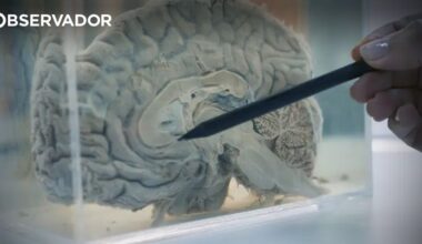 Pessoas com epilepsia são quase o dobro do estimado – Observador