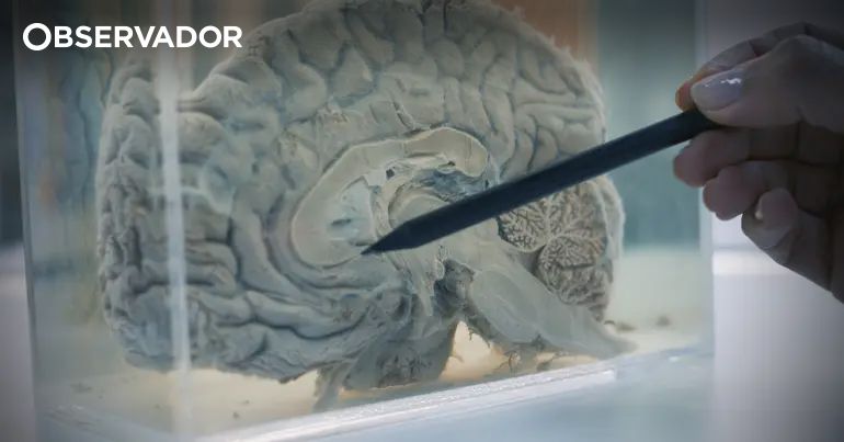 Pessoas com epilepsia são quase o dobro do estimado – Observador