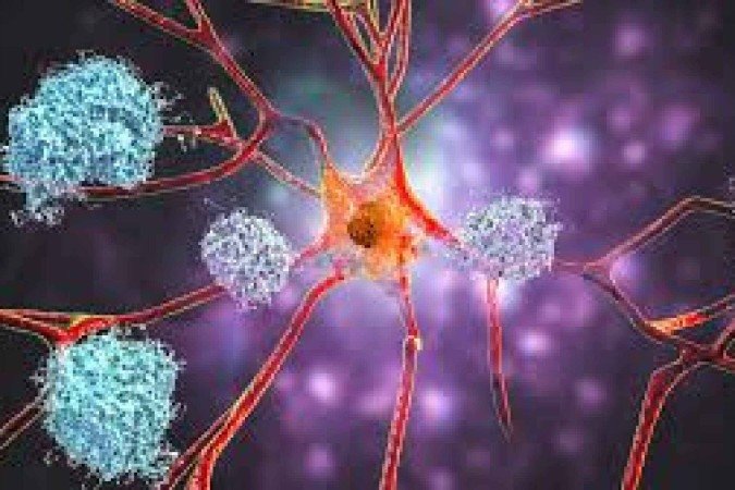 O acúmulo de substâncias tóxicas estimulado pela exposição a poluentes atmosféricos destrói as células cerebrais