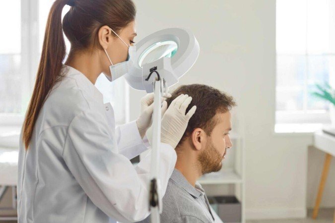 A alopecia areata causa falhas arredondadas no cabelo (Imagem: Studio Romantic