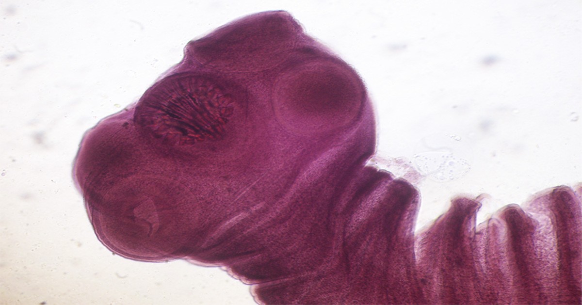 larva de tênia é a principal causa da doença em regiões de baixa e de média renda