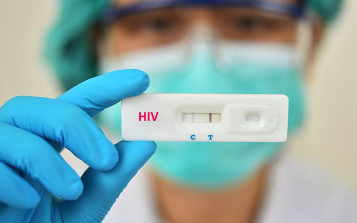 MT tem alta de HIV, Aids e outras doenças sexualmente transmissíveis