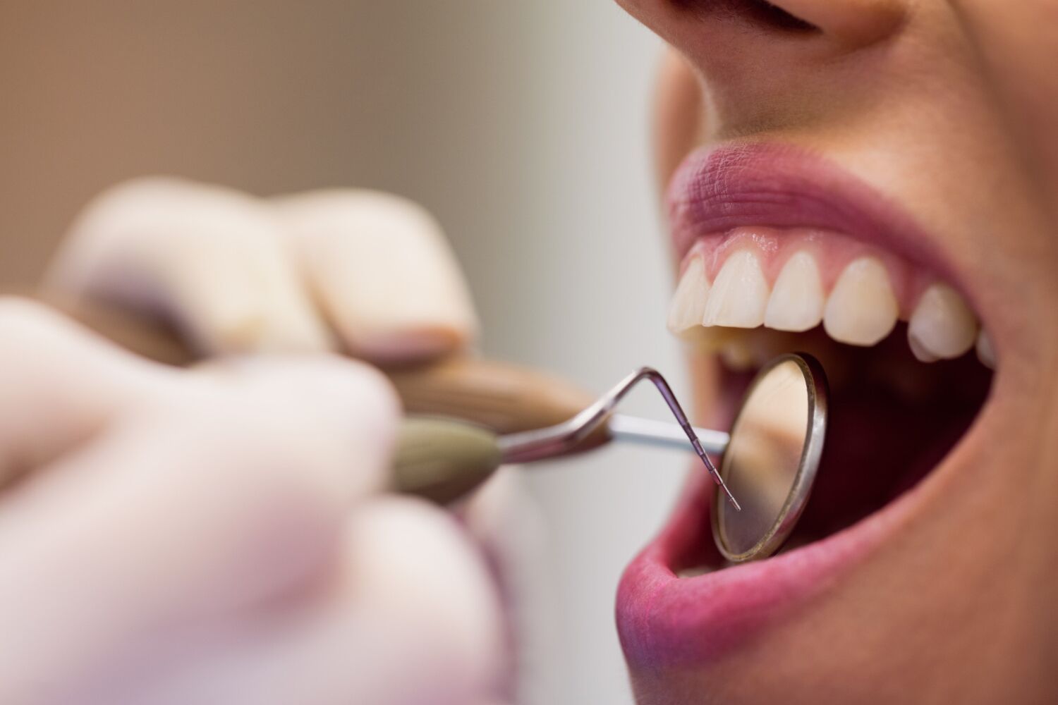 Estudo sugere que as bactérias nas nossas bocas podem causar ataques cardíacos