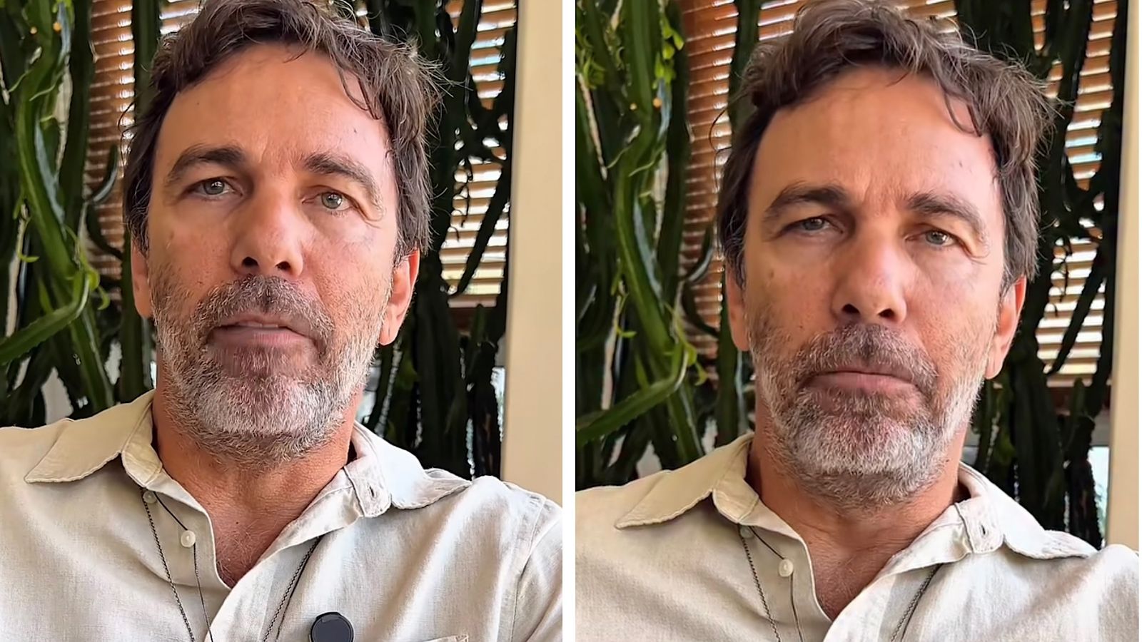 Marcelo Faria revelou que teve o herpes-zóster- Foto ReproduçãoInstagram @celofaria