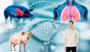 Pulmão: O Primeiro Transplante de Porco Realizado