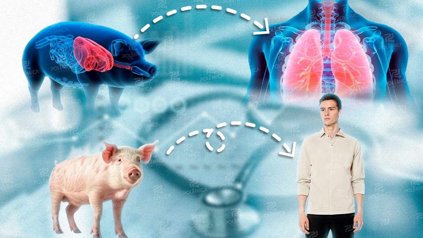 Pulmão: O Primeiro Transplante de Porco Realizado