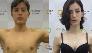 Bella Longuinho mostrou antes e depois de passar pela transição de gênero