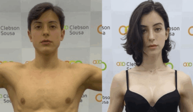 Bella Longuinho em seu antes e depois (Foto:Reprodução/Instagram @bella_longuinho)