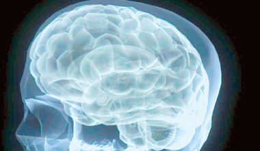 Conheça novo tratamento que substitui células cerebrais