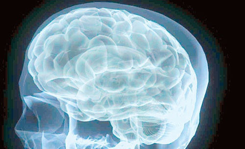 Conheça novo tratamento que substitui células cerebrais