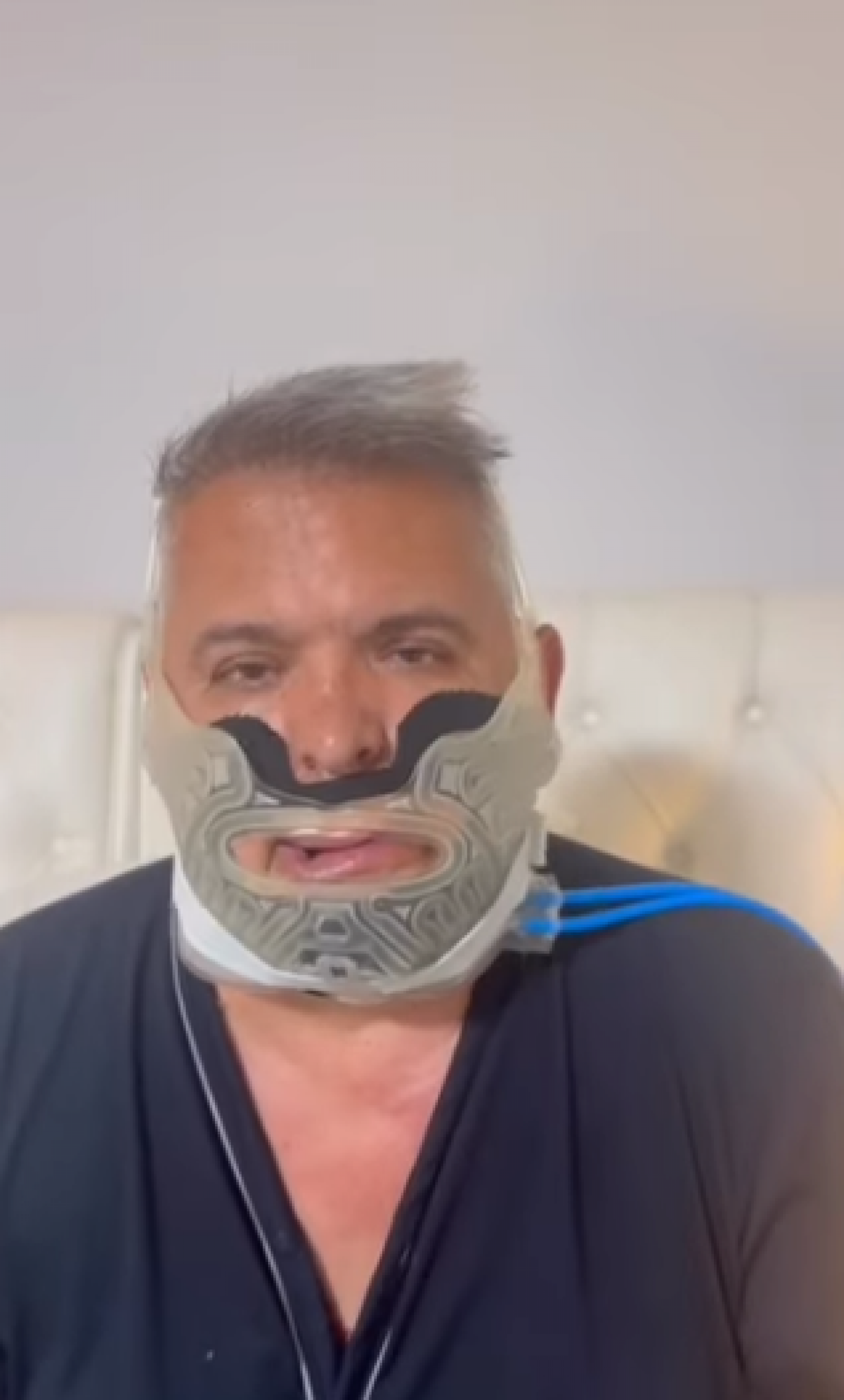 Orlando Morais passa por cirurgia 'difícil' para tratar apneia do sono - Reprodução de vídeo / Instagram