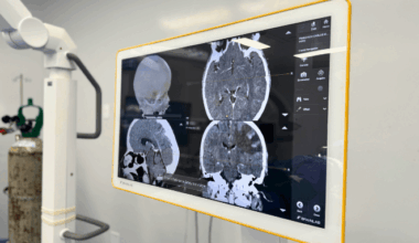 Com uso de tecnologia de ponta, HRVJ realiza aproximadamente 22 mil cirurgias em três anos