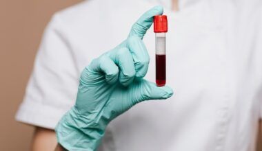Prever o futuro? Cientistas dos EUA criam exame de sangue que detecta câncer de cabeça e pescoço até 10 anos antes dos sintomas